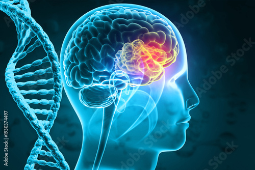 Fotografie Anatomical 3D model of a human brain showing a localized tumor growth alongside a glowing double-helix DNA strand to represent genetic mutation