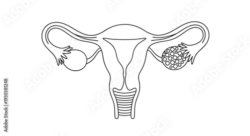Simple black and white line drawing of female human internal reproductive system showing uterus fallopian tubes and ovaries.