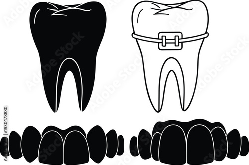 Dental tooth and braces silhouettes set isolated on white background, orthodontic treatment and teeth alignment black vector illustration