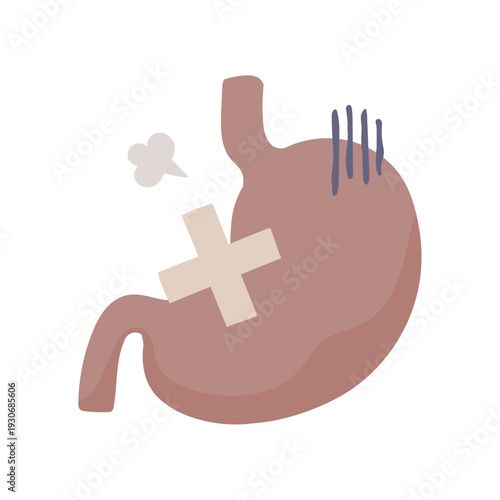 Illustration of an unhealthy-looking stomach with a bandaid on it