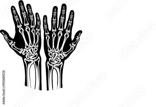 Two anatomical diagrams of human hands, showcasing bone structure