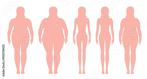 Vector illustration of a woman before and after weight loss. Female body in flat style. Successful diet and sport concept. Slim and fat girls.