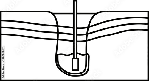 Simple line drawing of a hook or probe inserted into a layered material.
