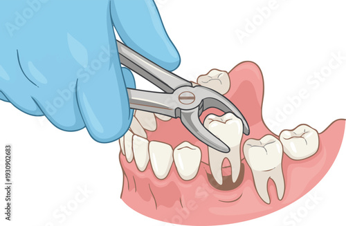 Anatomical illustration of the human pelvis, meticulously detailing the bony structure of the hip and its crucial components within the skeletal system for medical and educational contexts