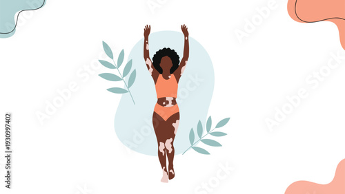 Beautiful black woman with vitiligo skin condition posing in an orange bikini with her arms raised against an abstract background with leaves.