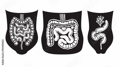 Three stylized depictions of human intestinal systems within black shield shapes, medical illustrations