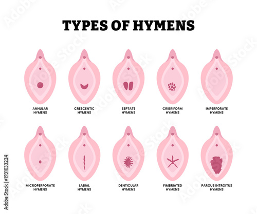 Different types of hymen shape types. Labeled annular, crescentic, septate, cribriform, imperforate, microperforate, labial, denticular, fimbriated, parous introitus. Maidenhead vector illustration.