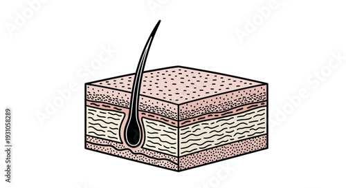 Cross section of skin with hair follicle, epidermis, dermis, and subcutaneous layers