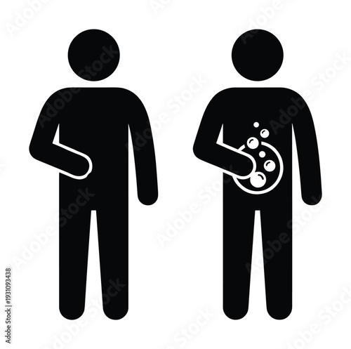 Stick figures with digestive problems, showing bloated stomach with gas and discomfort in black and white glyph vector