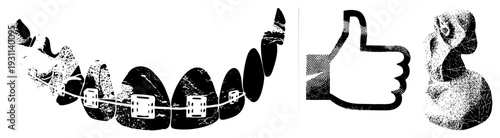 Orthodontic appliance on teeth, braces system, dental alignment tool, halftone graphic, social, isolated vector elements.