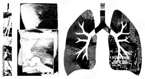 Black and white halftone illustration of human lungs, bronchial branching, respiratory anatomy, medical diagram, lung structure, pulmonary system, isolated vector graphic.