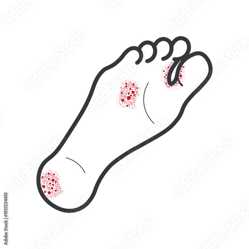 Isolated outline illustration of injured foot with skin wounds and irritation spots symbolizing infection, fungus, rash, healthcare problem