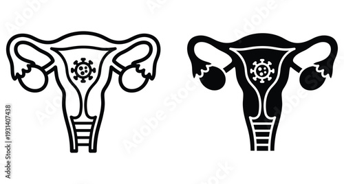 Female reproductive system icons showing uterus infection with virus or bacteria symbols for gynecology medical health education and diagnostic science research
