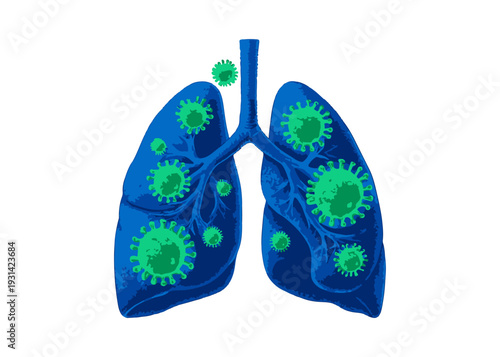 Human Lungs with Virus Infection Medical Flat Vector Illustration