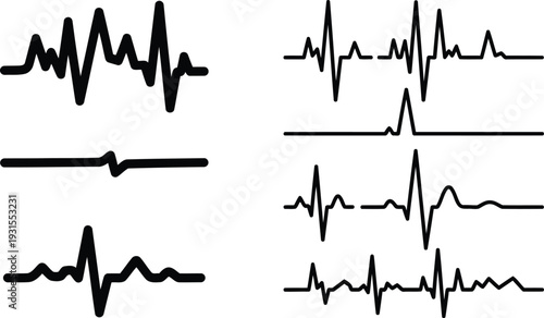 collection of various electrocardiogram tracings on white background