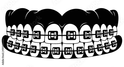 Orthodontic braces on upper and lower teeth illustration for dental correction and orthodontic treatment plans