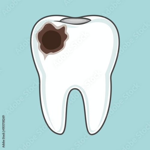 Tooth with large cavity vector illustration , Dental decay and toothache concept