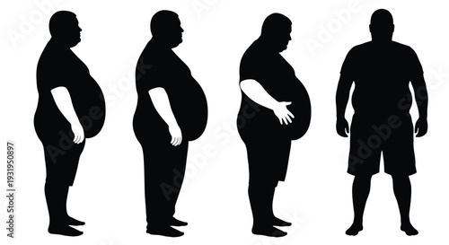 Silhouette vector graphic illustrating various stages of male obesity progression and body shape changes