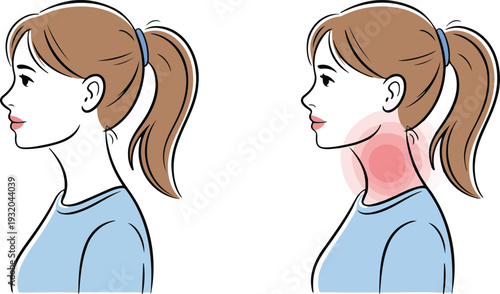 Female side profile illustration comparing forward head posture and correct neck alignment for health education and ergonomic awareness design