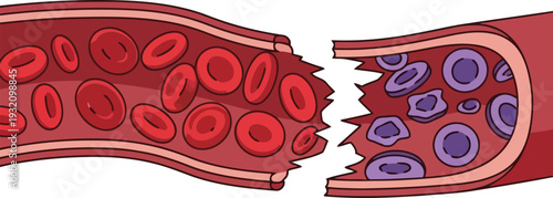 Vector illustration of broken blood vessel with red and white blood cells for medical and healthcare concepts
