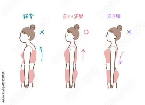 横から見た正しい姿勢と猫背と反り腰の女性の比較イラストセット