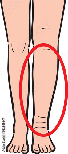 片方だけが浮腫んでいる脚