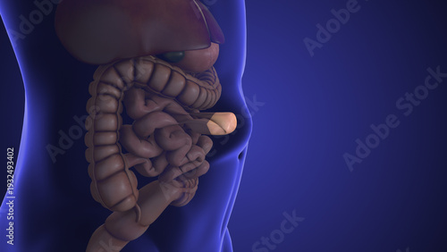 Upper Abdominal Wall Epigastric Hernia Formation