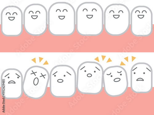 悪い歯並びから綺麗な歯並びへ歯並びの改善 歯科イメージ セット