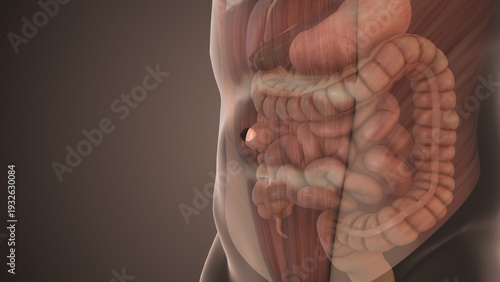 Epigastric Hernia Bulge in Abdominal Wall