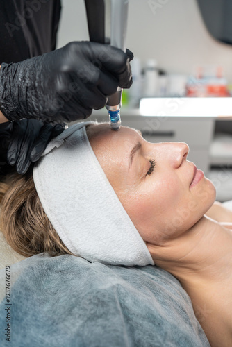 Professional performing microneedling treatment on a woman's forehead in a medical spa