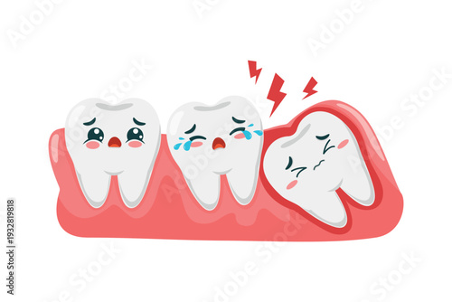 Vector illustration of a wisdom tooth located under the gum, causing pain and resting on other teeth due to decay. Concept for teeth and gum problems, impacted tooth, oral health and dentistry.