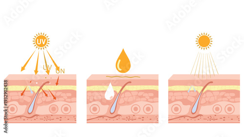 Scientific cross-section diagram of skin layers showing effects of UV radiation, hydration, and protection for dermatological education.