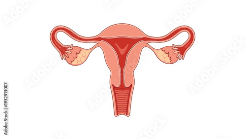 Detailed medical illustration of the female reproductive system in color showing the uterus, cervix, fallopian tubes, and ovaries for health education.