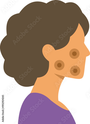 Woman showing skin condition like acne or moles on her face