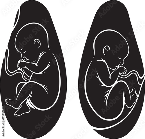 Two fetuses in dark amniotic sacs, intricate silver lines showing details, twin pregnancy concept