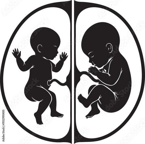 Twin babies inside maternal womb separated by amniotic sacs with umbilical cords silhouette illustration for medical education