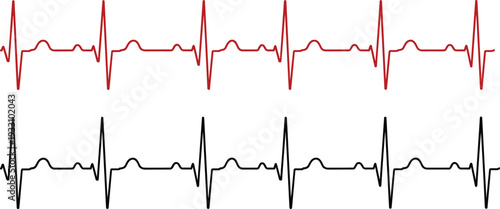 Medical Heart Rate EKG ECG Pulse Wave Line Featuring Red and Black Sinus Rhythm Vital Signs Monitor Vector Illustration Graphic