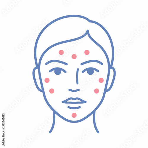 Face with Injection Points for Botox Treatment Illustration