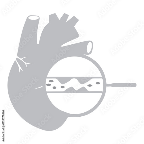 Heart Disease Illustration