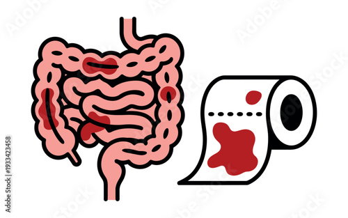 An illustration of a human digestive system with inflamed areas and a roll of toilet paper with blood stains
