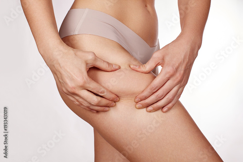 Wallpaper Mural Woman Pinching Thigh Showing Cellulite Closeup Study Of Skin Texture And Dimples, Underwear Visible, Subtle Soft Lighting, Neutral Studio Background, Selfexamination Mood, Cosmetic Concern And Body Torontodigital.ca