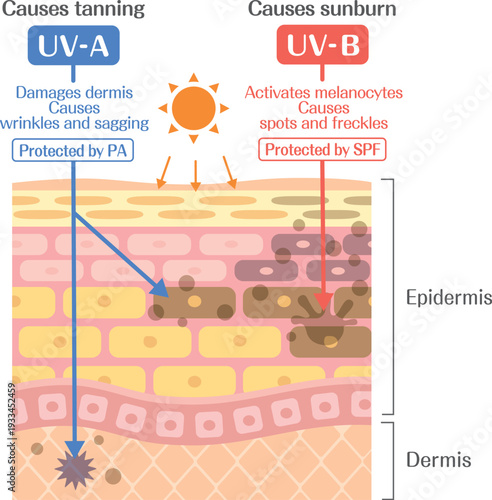 UVA and UVB effects on skin layers, SPF and PA protection diagram, skin cross section medical illustration