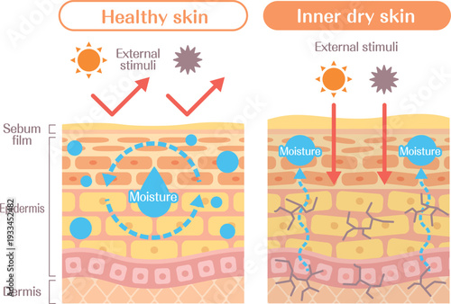 Inner dry skin structure diagram comparison