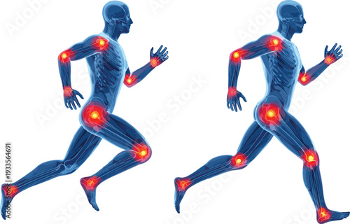 Anatomical illustration of a human runner with red glowing points indicating joint pain inflammation in knees hips and elbows