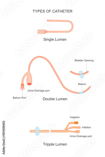 Sperm are male reproductive cells that carry DNA, move with a tail, and fertilize the female egg, playing a vital role in human reproduction and fertility.Vector illustration.

