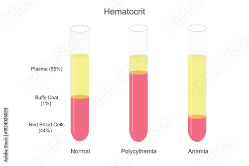 Hematocrit is the percentage of red blood cells in blood, indicating oxygen-carrying capacity and helping diagnose anemia, dehydration, and other disorders.Vector illustration.
