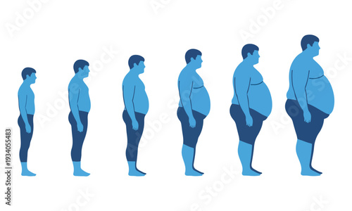 Male Body Obesity Progression Stages Illustration Chart