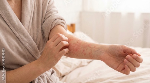 Woman scratches atopic skin. Dermatitis, diathesis, allergy on the body.	