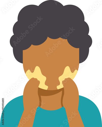 Person with vitiligo, an autoimmune skin condition causing depigmentation, embracing self acceptance