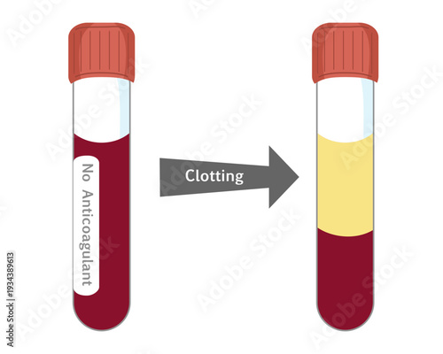 Blood Serum Separation Process - Blood Clotting in Test Tube without Anticoagulant
